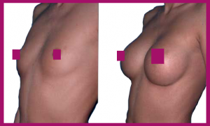 Breast Actives 10